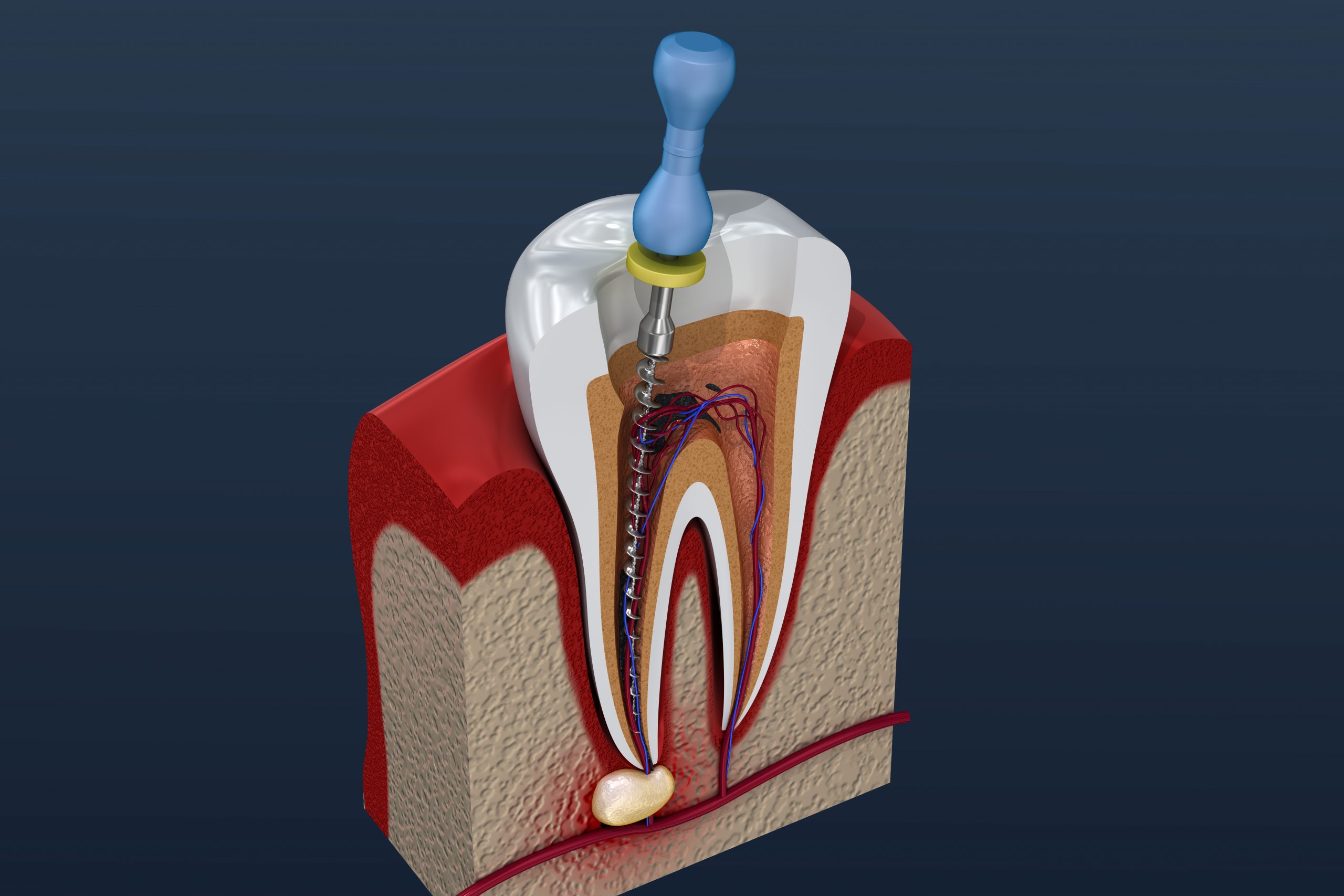 Tooth cross-section showing root canal