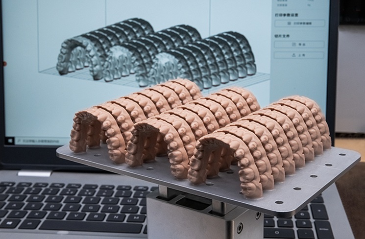 The Rise of 3D Printing in Restorative Dentistry: A Game Changer